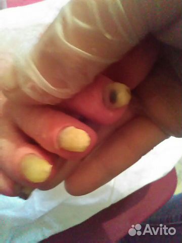 Педикюр для пожилых людей.Выезд во все районы