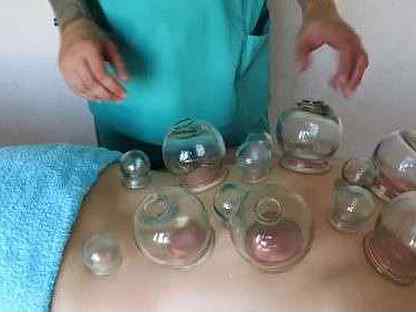 Банки постановка алгоритм. Действие банок связано с. Действие банок связано с. Схема постановки медицинских банок. Консервные банки привязанные к машине.